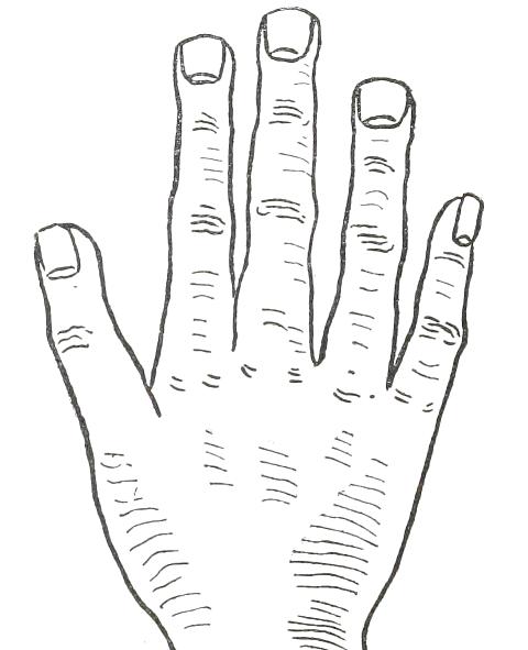 Fig. 24

SQUARE HAND