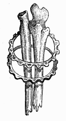 Fore-arm, encircled with Bracelets